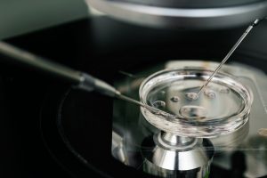 Erfolgreiche IVF: Mehrere Faktoren spielen eine Rolle 1